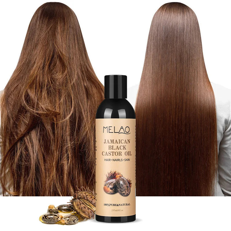 Pure Natural Cold Pressed Castor Oil Promotes Healthy Skin and Hair  Thickens