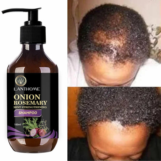 Hair Shampoo For Fast Hair Growth Rosemary Onion Hair