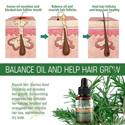 Rosemary Oil Hair Growth Essential Coconut Oil Improve Hair