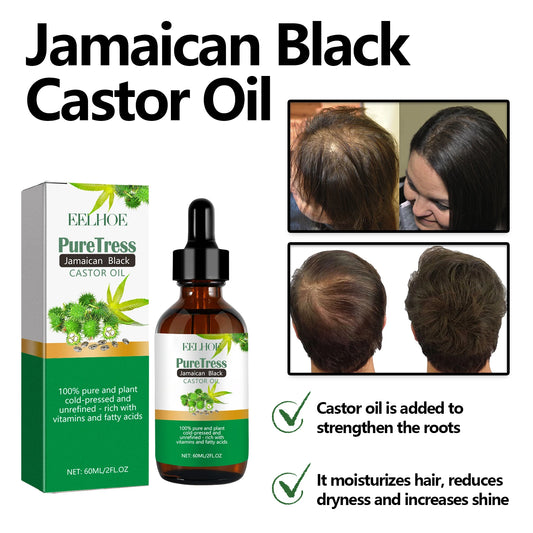 Castor Scalp Hair Strengthening Oil Biotin Essential Oil Deeply Moisturize