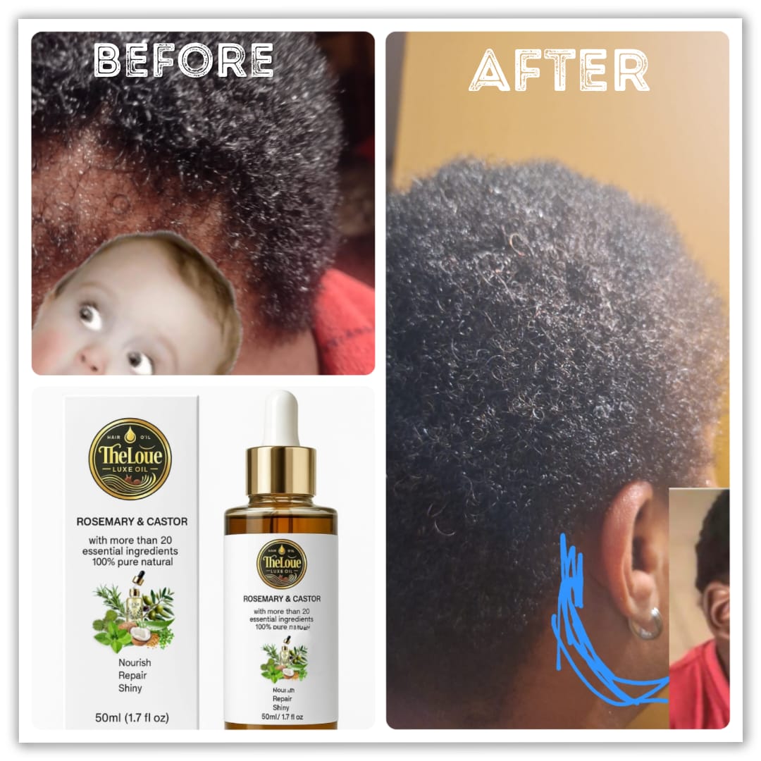 Theloue Luxe Oil Rosemary & Castor Hair Oil 50 ml | Growth, Repair & Shine | 100% Pure Natural Ingredients