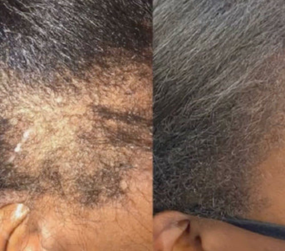 ✨ The Luxe Self-Care Collection
Healthy Hair. Glowing Skin. All in- One Luxe Set.