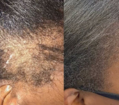 ✨ The Luxe Self-Care Collection
Healthy Hair. Glowing Skin. All in- One Luxe Set.